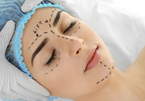 The Benefits of Top Plastic Surgeons in Beverly Hills CA